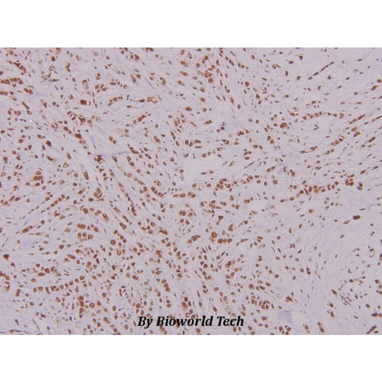 Anti-FoxK1 (G698) Antibody from Bioworld Technology (BS2293) - Antibodies.com