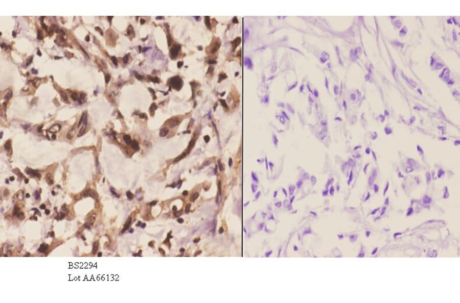 Anti-PFKP (Q365) Antibody from Bioworld Technology (BS2294) - Antibodies.com
