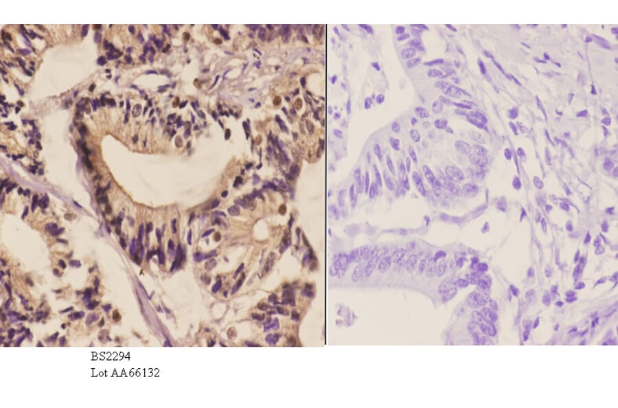 Anti-PFKP (Q365) Antibody from Bioworld Technology (BS2294) - Antibodies.com