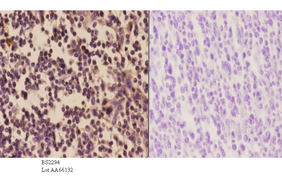 Anti-PFKP (Q365) Antibody from Bioworld Technology (BS2294) - Antibodies.com