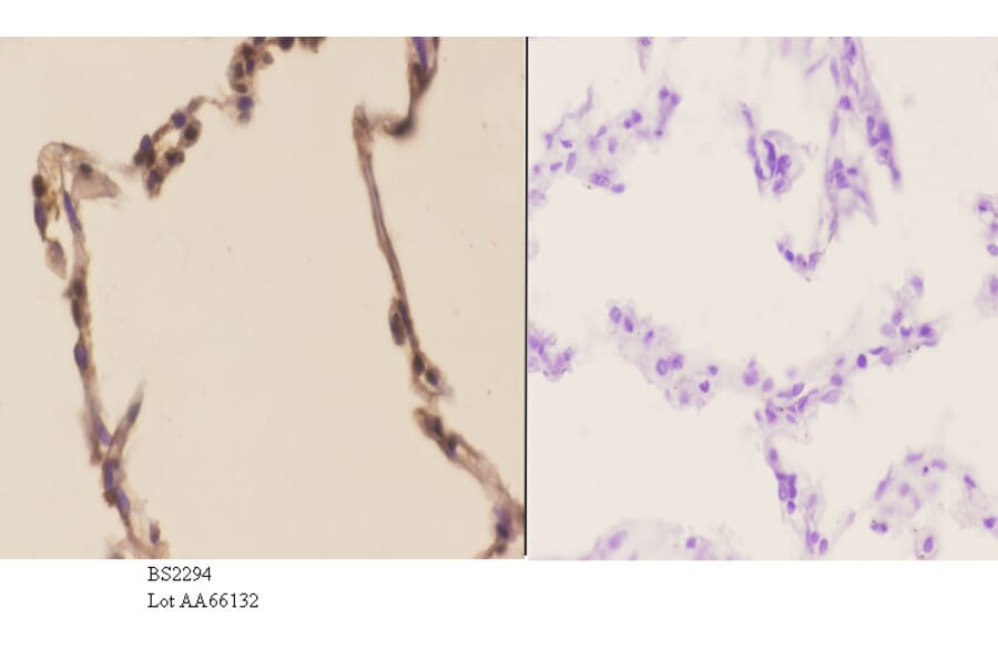 Anti-PFKP (Q365) Antibody from Bioworld Technology (BS2294) - Antibodies.com
