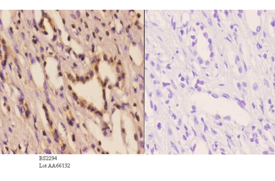 Anti-PFKP (Q365) Antibody from Bioworld Technology (BS2294) - Antibodies.com