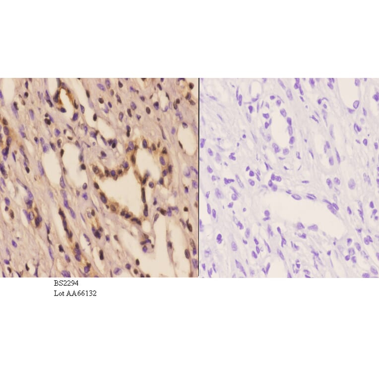 Anti-PFKP (Q365) Antibody from Bioworld Technology (BS2294) - Antibodies.com