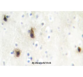 Anti-MVK (N175) Antibody from Bioworld Technology (BS2296) - Antibodies.com