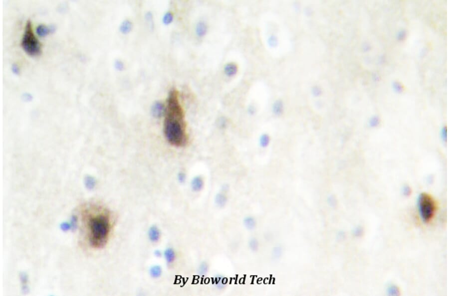 Anti-MVK (N175) Antibody from Bioworld Technology (BS2296) - Antibodies.com