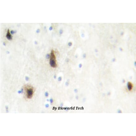 Anti-MVK (N175) Antibody from Bioworld Technology (BS2296) - Antibodies.com