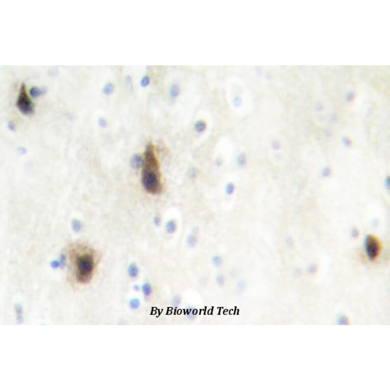 Anti-MVK (N175) Antibody from Bioworld Technology (BS2296) - Antibodies.com