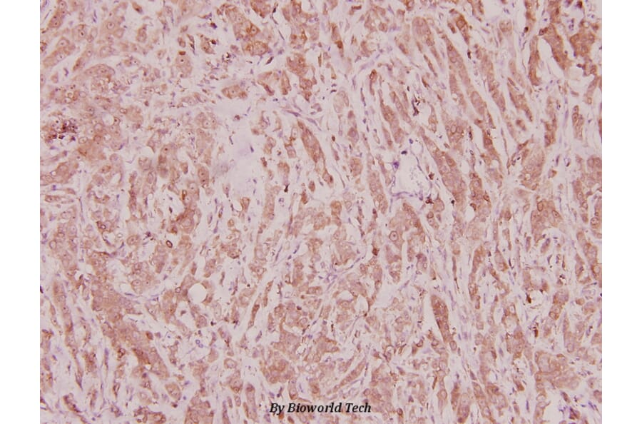 Anti-C/EBP ζ (D24) Antibody from Bioworld Technology (BS2297) - Antibodies.com
