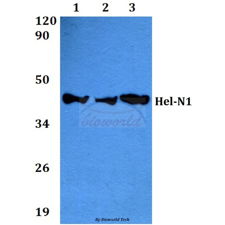 Anti-Hel-N1 (S27) Antibody from Bioworld Technology (BS2299) - Antibodies.com