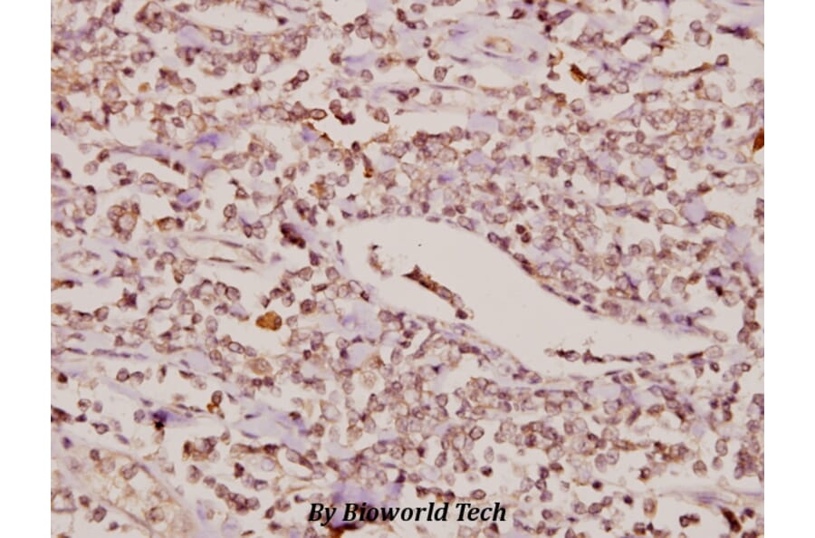 Anti-FoxC1/2 (K138) Antibody from Bioworld Technology (BS2300) - Antibodies.com
