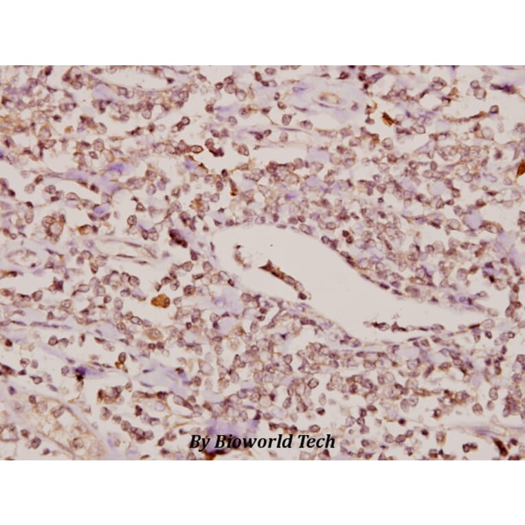 Anti-FoxC1/2 (K138) Antibody from Bioworld Technology (BS2300) - Antibodies.com