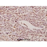 Anti-FoxC1/2 (K138) Antibody from Bioworld Technology (BS2300) - Antibodies.com