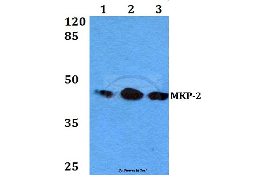 Anti-MKP-2 (Y108) Antibody from Bioworld Technology (BS2302) - Antibodies.com