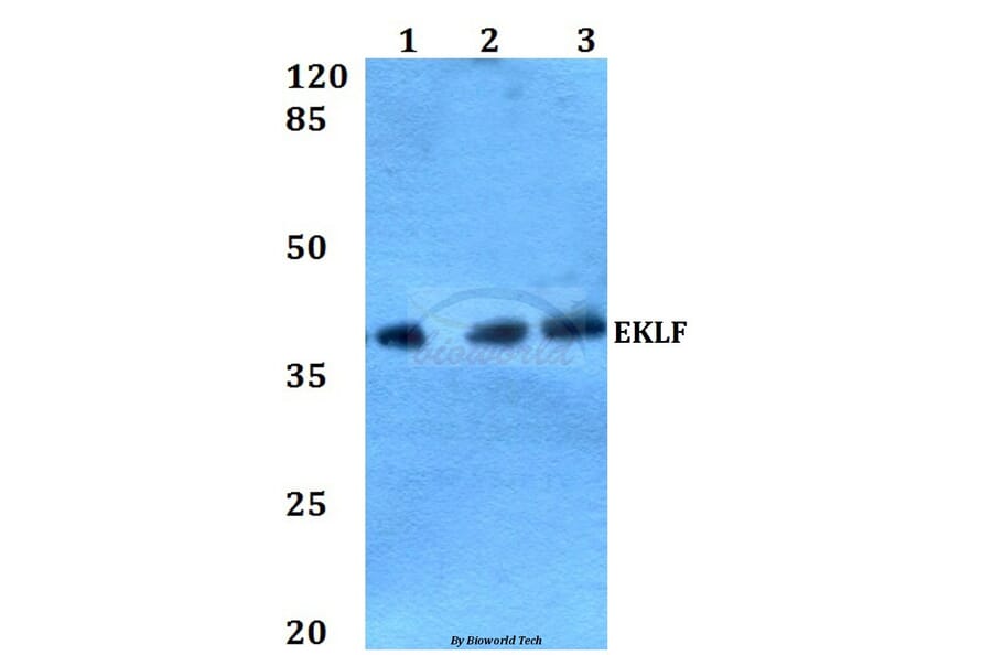 Anti-EKLF (W318) Antibody from Bioworld Technology (BS2303) - Antibodies.com