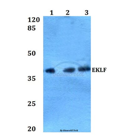 Anti-EKLF (W318) Antibody from Bioworld Technology (BS2303) - Antibodies.com
