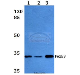 Anti-FoxE3 (R97) Antibody from Bioworld Technology (BS2304) - Antibodies.com