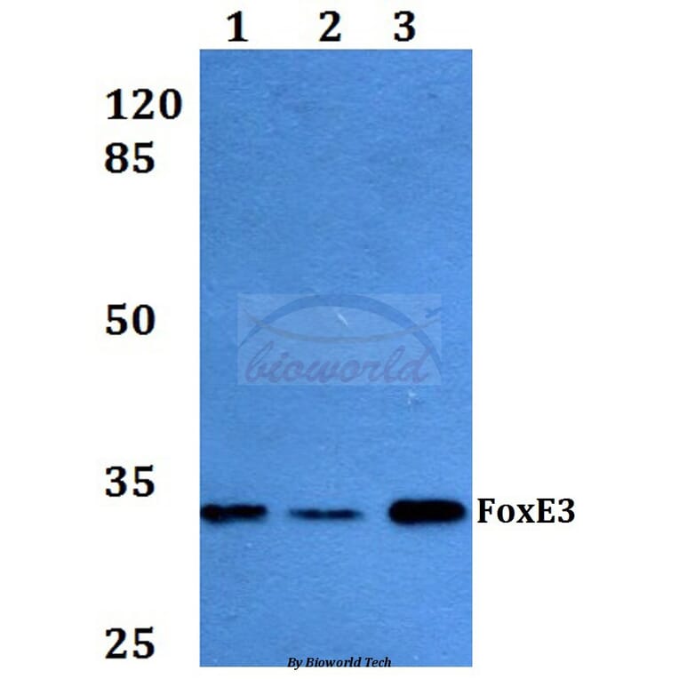 Anti-FoxE3 (R97) Antibody from Bioworld Technology (BS2304) - Antibodies.com