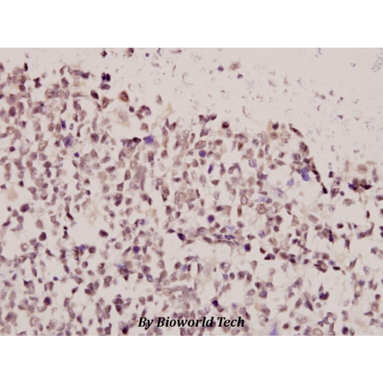 Anti-FoxE3 (R97) Antibody from Bioworld Technology (BS2304) - Antibodies.com