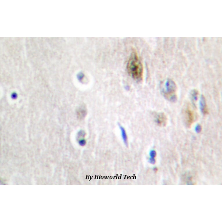 Anti-Tra-2α (G241) Antibody from Bioworld Technology (BS2305) - Antibodies.com