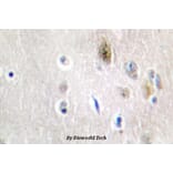 Anti-Tra-2α (G241) Antibody from Bioworld Technology (BS2305) - Antibodies.com
