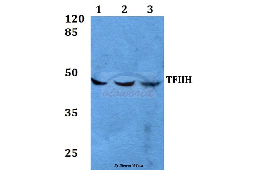 Anti-TFIIH p44 (T18) Antibody from Bioworld Technology (BS2306) - Antibodies.com