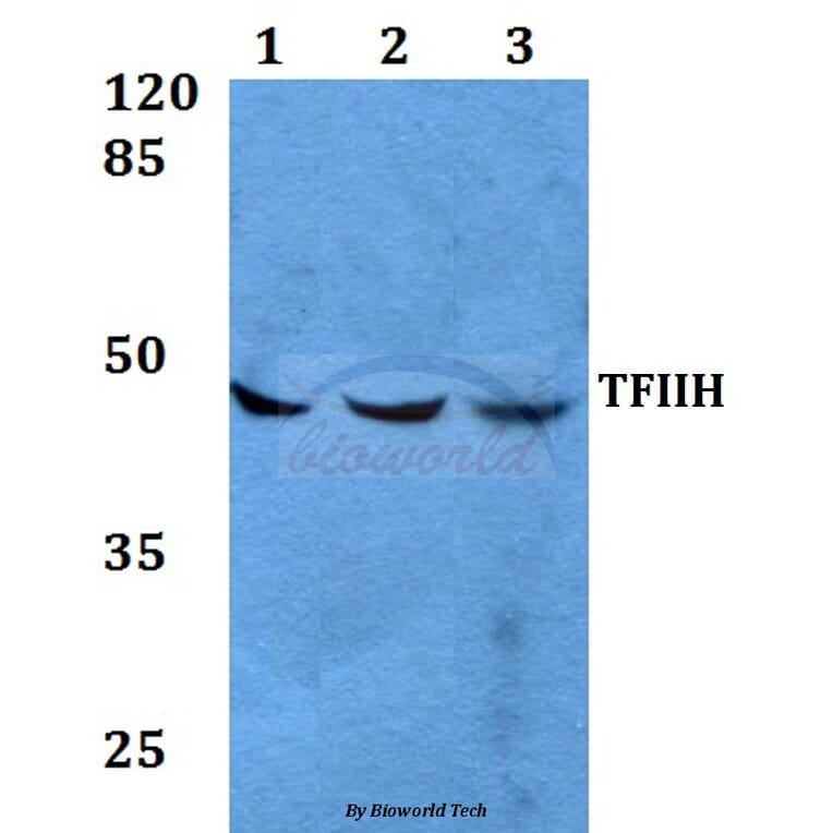 Anti-TFIIH p44 (T18) Antibody from Bioworld Technology (BS2306) - Antibodies.com