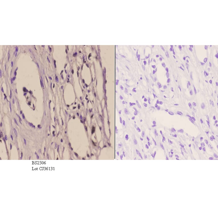 Anti-TFIIH p44 (T18) Antibody from Bioworld Technology (BS2306) - Antibodies.com