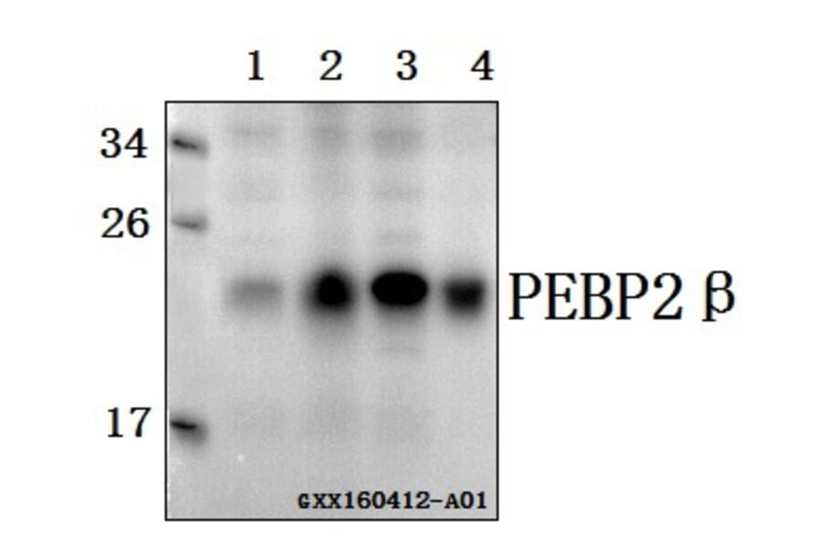 Anti-PEBP2β (R33) Antibody from Bioworld Technology (BS2307) - Antibodies.com