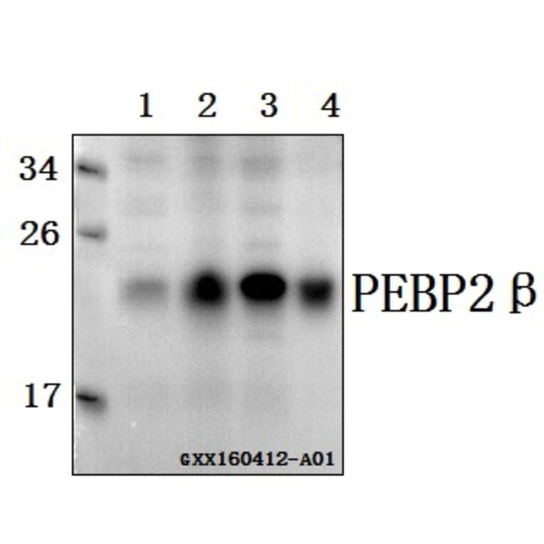 Anti-PEBP2β (R33) Antibody from Bioworld Technology (BS2307) - Antibodies.com