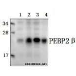 Anti-PEBP2β (R33) Antibody from Bioworld Technology (BS2307) - Antibodies.com