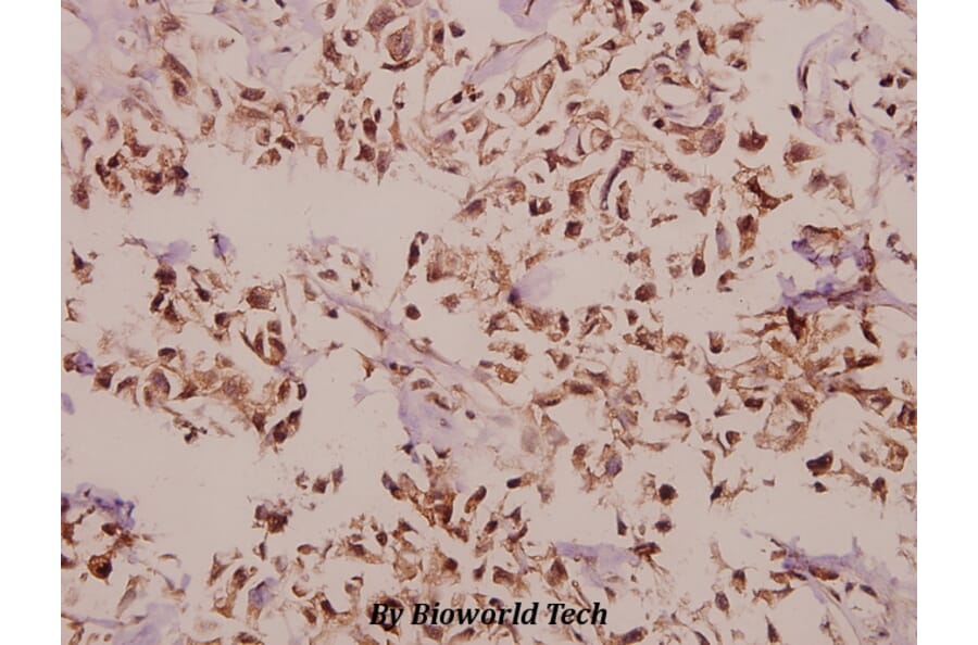 Anti-PEBP2β (R33) Antibody from Bioworld Technology (BS2307) - Antibodies.com