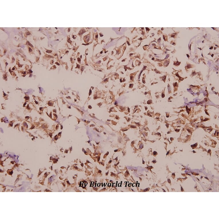 Anti-PEBP2β (R33) Antibody from Bioworld Technology (BS2307) - Antibodies.com