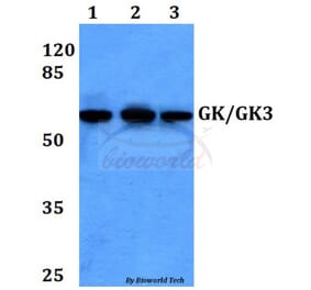 Anti-GK/GK3 (H39) Antibody from Bioworld Technology (BS2308) - Antibodies.com