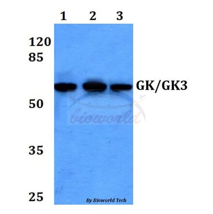 Anti-GK/GK3 (H39) Antibody from Bioworld Technology (BS2308) - Antibodies.com