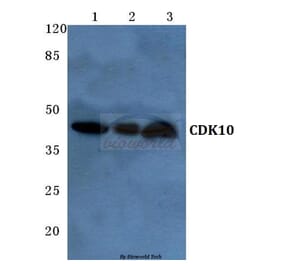 Anti-CDK10 (E63) Antibody from Bioworld Technology (BS2312) - Antibodies.com
