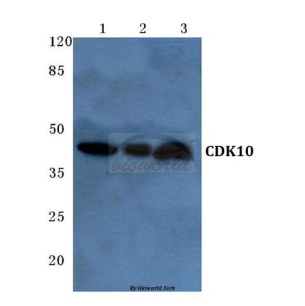 Anti-CDK10 (E63) Antibody from Bioworld Technology (BS2312) - Antibodies.com