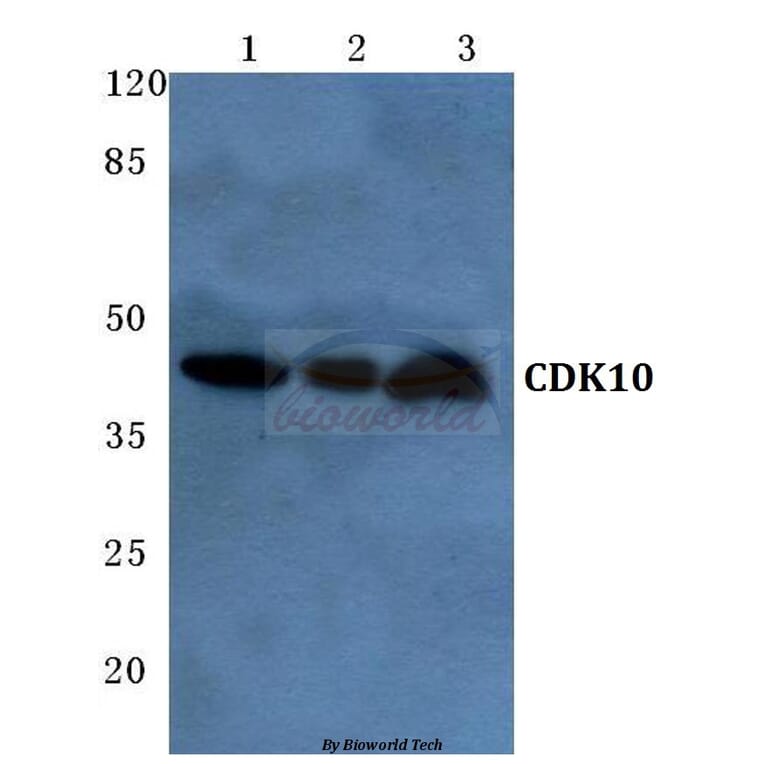 Anti-CDK10 (E63) Antibody from Bioworld Technology (BS2312) - Antibodies.com