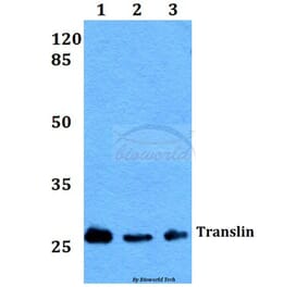 Anti-Translin (E121) Antibody from Bioworld Technology (BS2314) - Antibodies.com