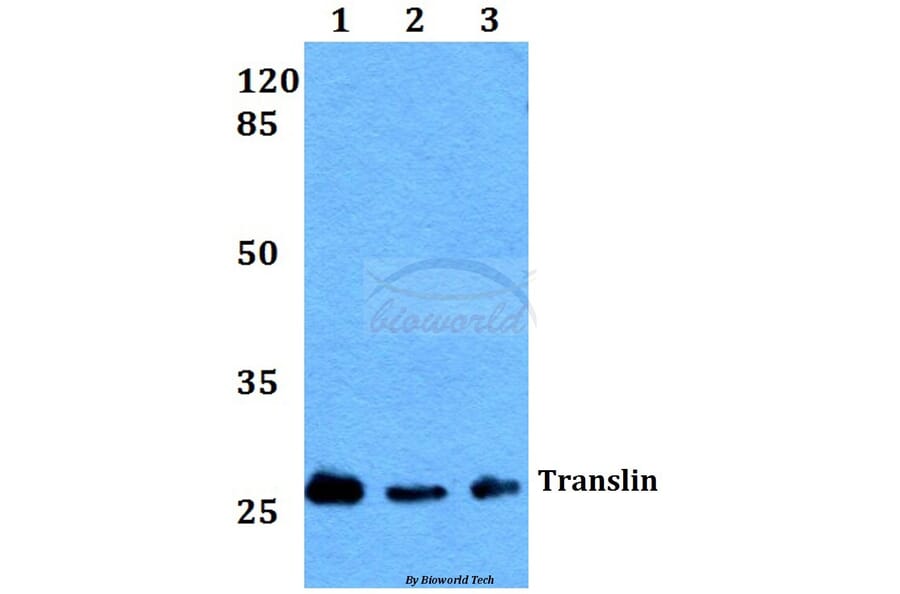 Anti-Translin (E121) Antibody from Bioworld Technology (BS2314) - Antibodies.com