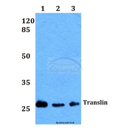 Anti-Translin (E121) Antibody from Bioworld Technology (BS2314) - Antibodies.com