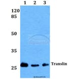 Anti-Translin (E121) Antibody from Bioworld Technology (BS2314) - Antibodies.com