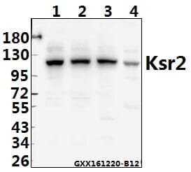 Anti-Ksr2 (I694) Antibody (A26206) | Antibodies.com