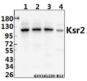 Anti-Ksr2 (I694) Antibody from Bioworld Technology (BS2321) - Antibodies.com