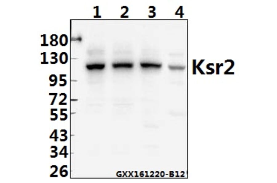 Anti-Ksr2 (I694) Antibody from Bioworld Technology (BS2321) - Antibodies.com