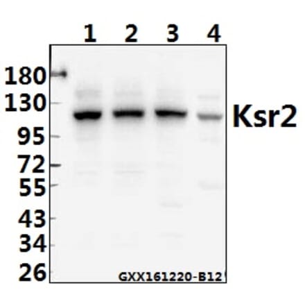 Anti-Ksr2 (I694) Antibody from Bioworld Technology (BS2321) - Antibodies.com