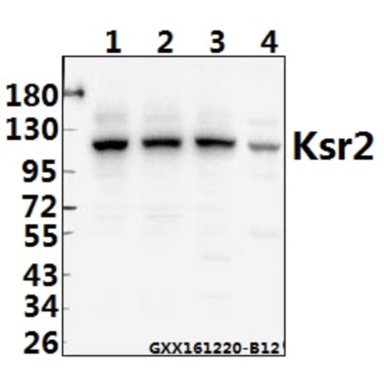 Anti-Ksr2 (I694) Antibody from Bioworld Technology (BS2321) - Antibodies.com