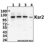 Anti-Ksr2 (I694) Antibody from Bioworld Technology (BS2321) - Antibodies.com