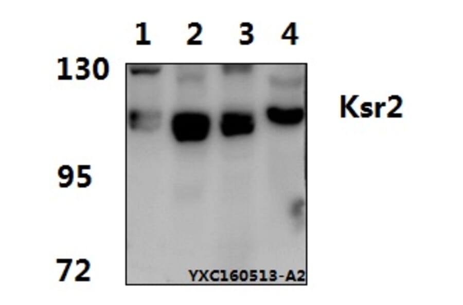 Anti-Ksr2 (I694) Antibody from Bioworld Technology (BS2321) - Antibodies.com