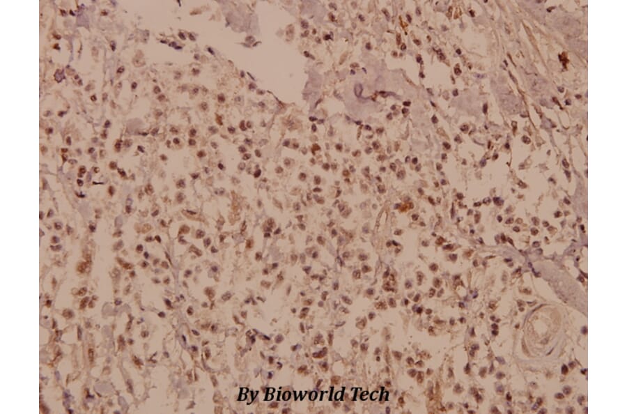 Anti-CUG-BP1/2 (K95) Antibody from Bioworld Technology (BS2339) - Antibodies.com