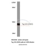 Anti-Tsg 101 (E303) Antibody from Bioworld Technology (BS2347) - Antibodies.com